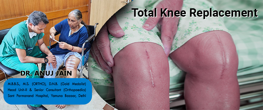Top-knee-replacement-surgeon-in-Noida-Delhi-NCR