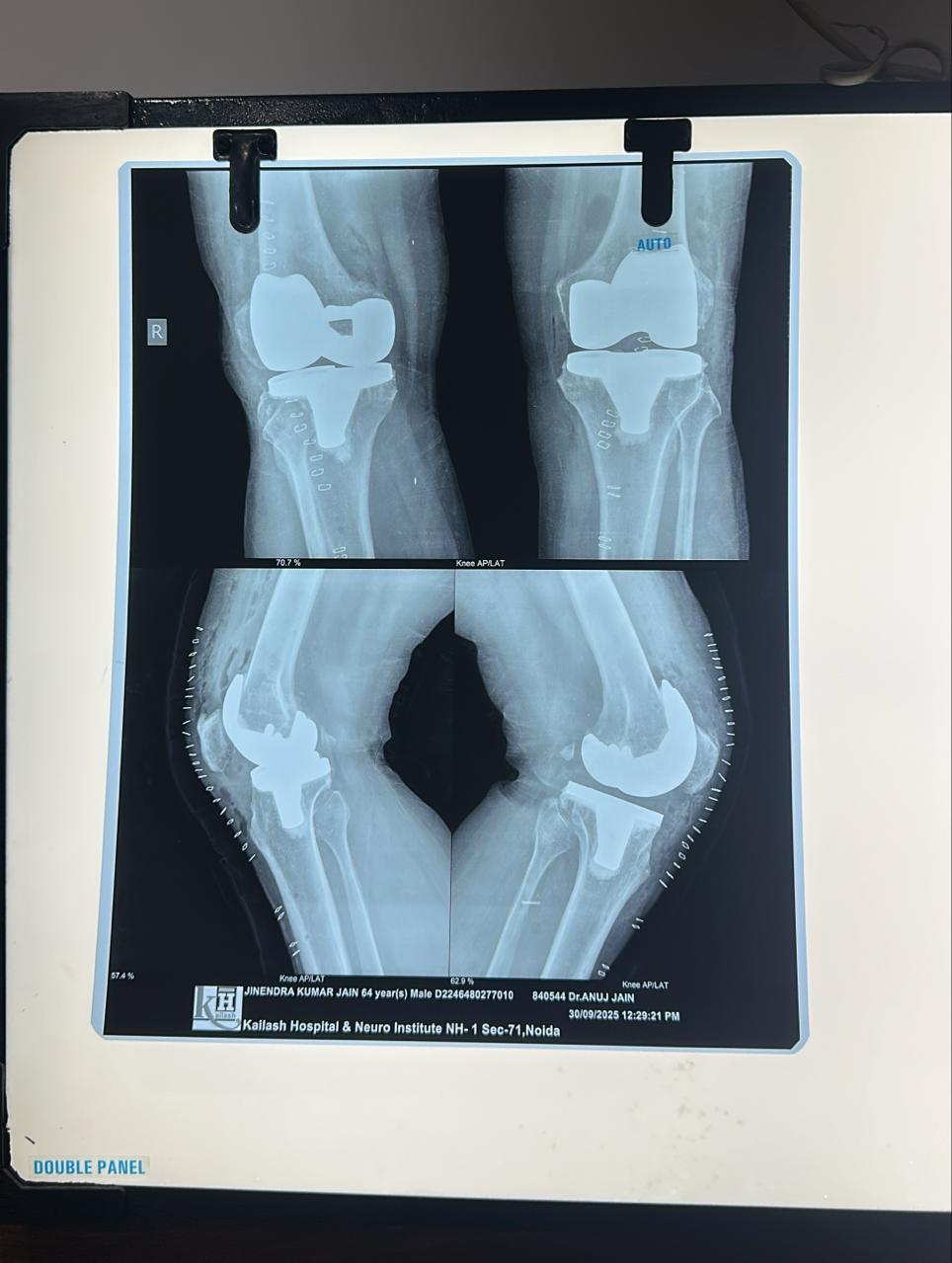 Postoperative X-ray Findings