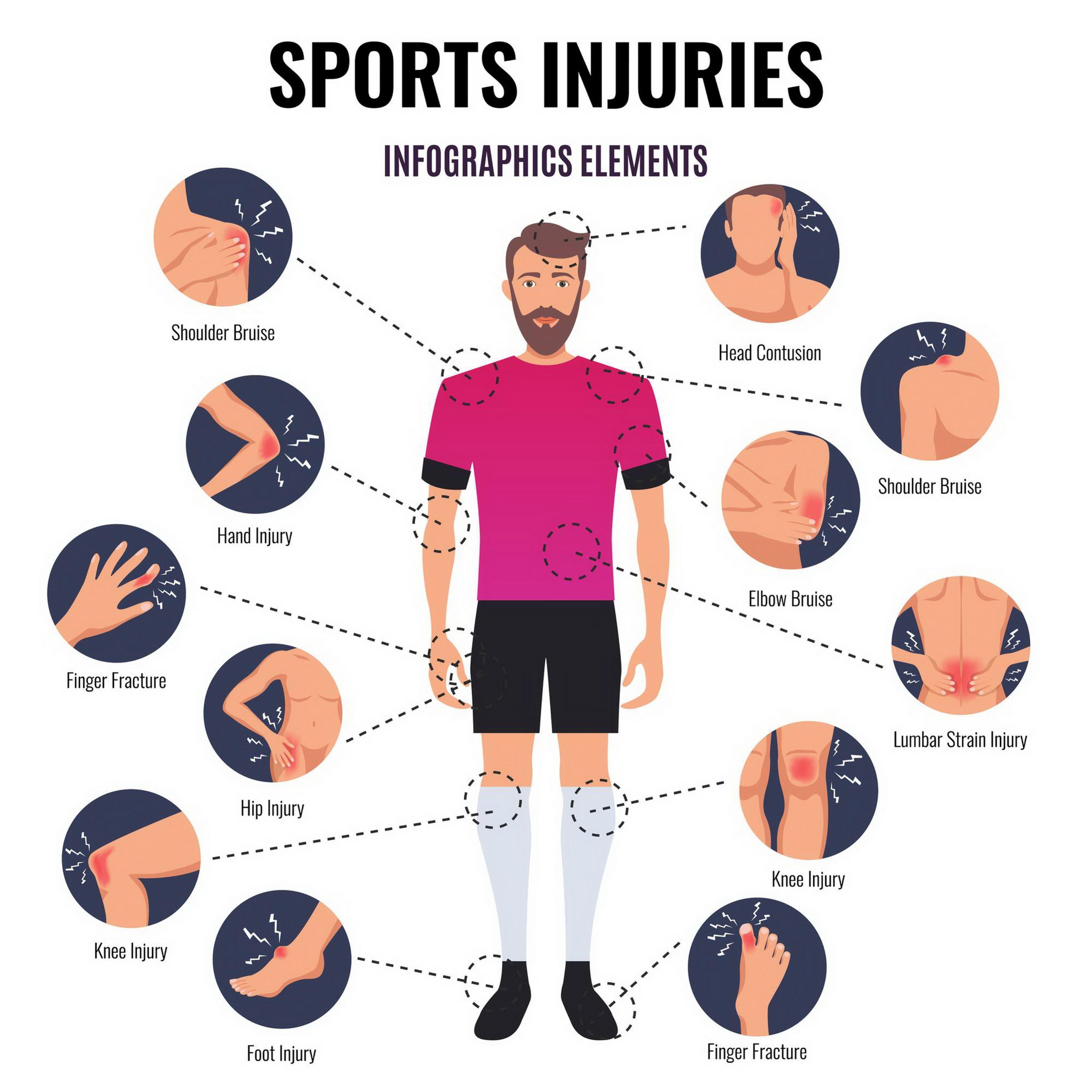 sports injuries