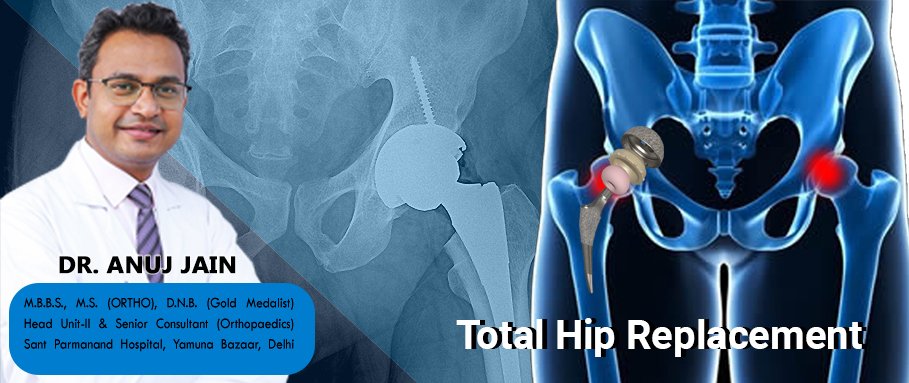 best-hip-replacement-surgeon-in-delhi-noida-ncr