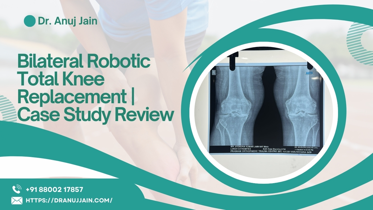 Bilateral Robotic Total Knee Replacement

