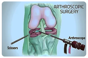 Dr Anuj Jain - Arthroscopic Surgery